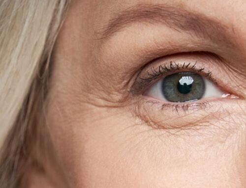 Parksville’s Non-Surgical Eye Lifts