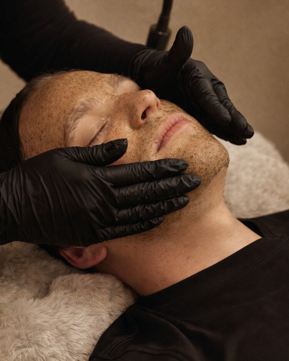 Chemical Peels in Parksville B.C | Elegance Sculpting | Full Service Medical Spa